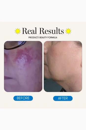 كبسولات الجمال، 180 كبسولة