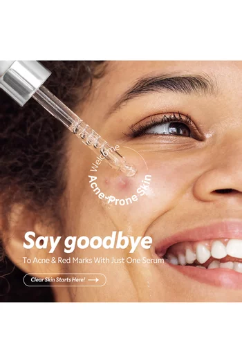 Azelaic Acid 12% Serum, 30ml