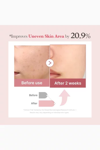 سيروم الإكسوسومات الوردي بالكولاجين ومركب بوليديوكسيريبونكليوتيد 7500 جزء في المليون، سيروم سائل معزز للبشرة